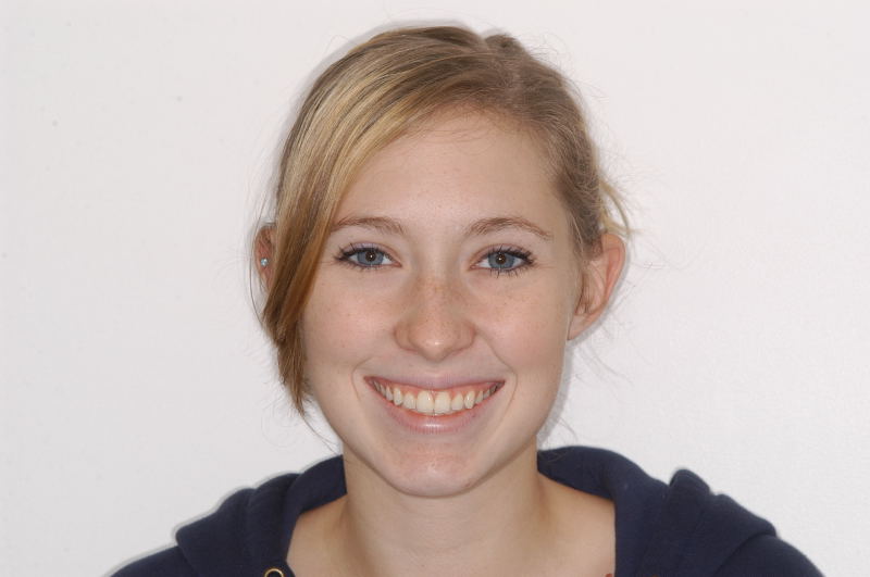 17.5 yr retention smile