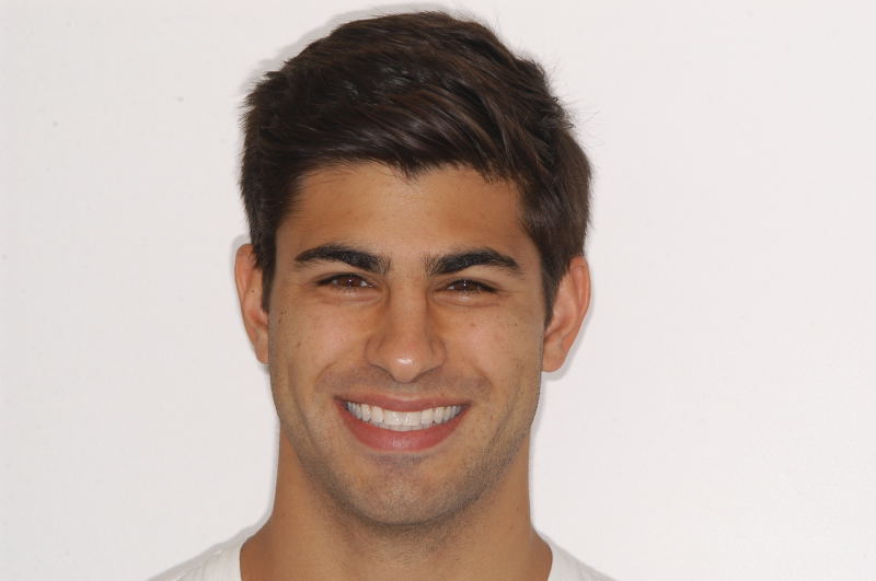 15.6 yr retention smile