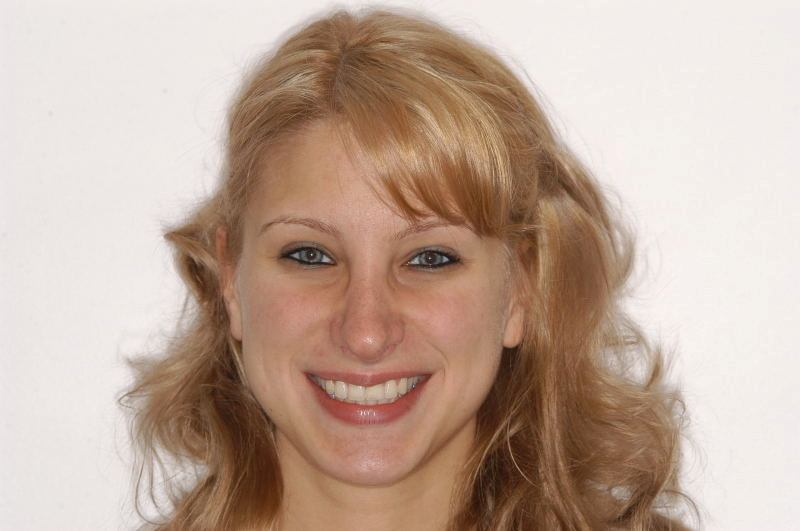 11.7 yr retention smile