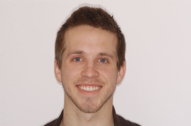 14.6 yr retention smile