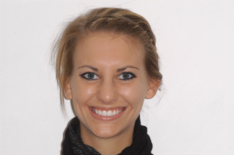 16.5 yr retention smile
