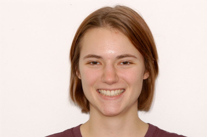 09.8 yr retention smile